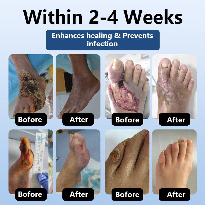 DiabeHeal™ Diabetic Skin Healing Cream