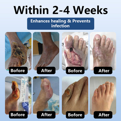 DiabeHeal™ Diabetic Skin Healing Cream