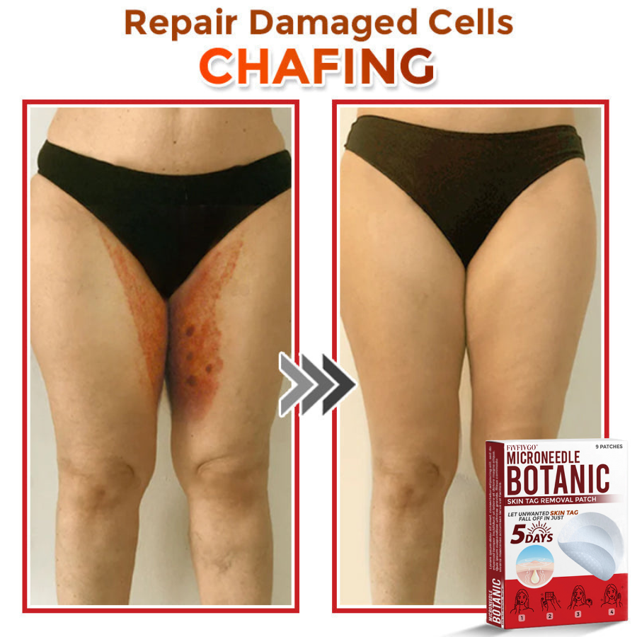 VanaSculpt®  Botanical MicroNeedle Skin Tag Therapy Patch