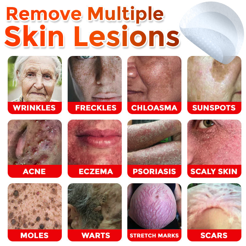 VanaSculpt®  Botanical MicroNeedle Skin Tag Therapy Patch
